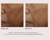 Even & Correct Advanced Brightening Treatment