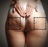 Smooth Away Cellulite with Sculpt