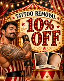 Tattoo Removal- 10% off treatments