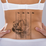 Tattoo Removal- 10% off treatments